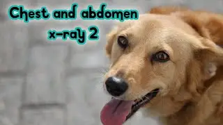chest and abdomen x-ray 2