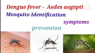 Dengue fever l Aedes l mosquito lsign symptoms l prevention lडेंगू बुखार lएडीज   l रोकथाम