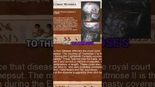 The Exodus: Evidence for the Plague of Boils