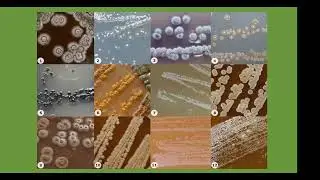 Filamentous Bacteria - Actinomycetes , Dr. Thet Minn Thaung