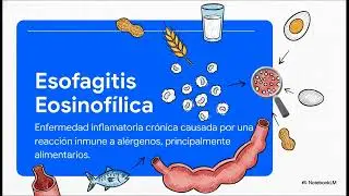 Trastornos del Es&oacute;fago | ENURD El medico de hoy