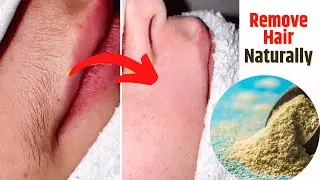 unbelievable!| how to get rid of facial hairs, remove ingrown hairs permanently !