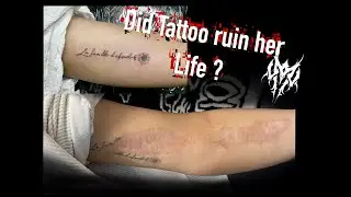 Scar cover up // Tattoo // M.W. Tattoo
