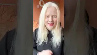 Альбиносы страшные?! #альбинос #альбиносик #albino