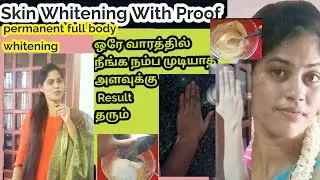 My top best skin whitening Remedy in my list/Skin Whitening soap in Tamil