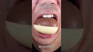 The Most Satisfying Chocolate and Candy ASMR Compilation 🍫🍬 #DoctorTristanPeh #Chocolate #Candy