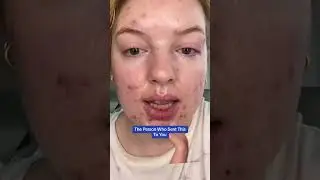 👯 Send to Your Acne-Fighting Bestie: Differin Gel