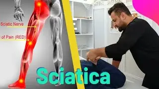 Natural Sciatica Relief &mdash; Massage Therapy That Really Works!