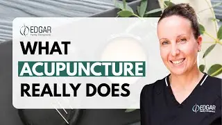 Medical Acupuncture Explained: Facts, Safety, What to Expect