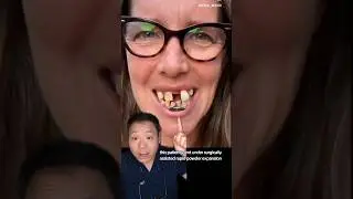Amazing Smile Transformation with Braces - Dentist Explains #smile #braces