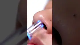 &ldquo;Charcoal Nose Strip Peel-Off 😌 | Sticky Pop ASMR & Deep Pore Clean&rdquo;