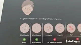 Urządzenie BEMER &ndash; czyli co? Więcej w opisie👇Zamow już dziś w linku w komentarzu