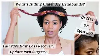 What's Hiding Under My Headbands? - Fall 2024 Hair Loss Update - 4C Natural Hair - NaturalMe4C
