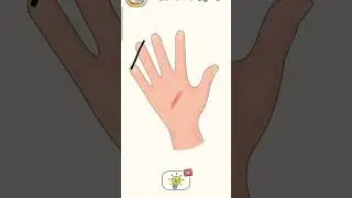 The 