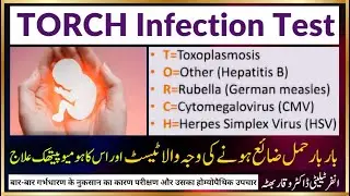 TORCH Test ٹارچ ٹیسٹ टॉर्च परीक्षण Toxoplasmosis, Rubella, Cytomegalovirus Herpes , Homeopathic ilaj