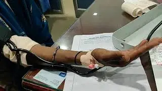Trousseau's sign&nbsp;is carpopedal spasm