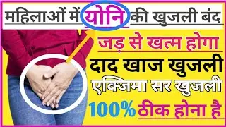 Griseofulvin FP। Grisovin FP Tablet। Use। Dose। Side effect। Intrection। #medicine #doctor #drug