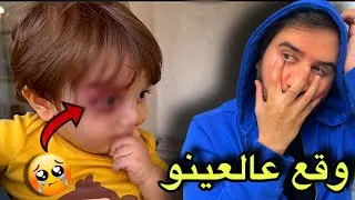 علوش وقع عالعينو شوفو تفاصيل العملية😭💔