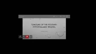 73 Tumours of pituitary hypothalamic region