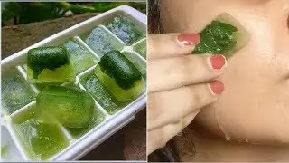 Remove Pimples/Acne Overnight - Neem ice cubes Remove Dark Spots, Blemishes, Acne Scars