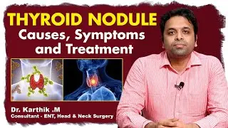 Thyroid Nodule Treatment | Best ENT Doctor in Hyderabad | Thyroid Nodules | Dr Karthik| TX Hospitals