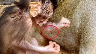 Poor Baby Quinton So Hurt Was Bite By Big Red Ant