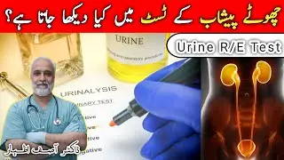 Urine Test Report Kaise Dekhe || Urine Test In Hindi || Urine Test Report || Urine Test Analysis