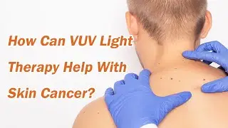 How Can VUV Light Therapy Help with Skin Cancer？