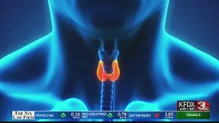 Thyroid Awareness (HealthyYou)