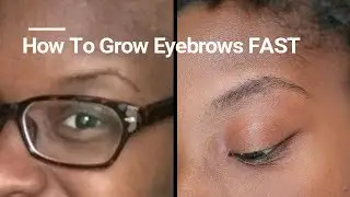 ROGAINE FOR EYEBROW GROWTH