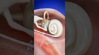 Как некоторые глухие люди могут слышать 🤔