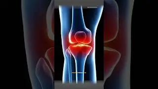 Physiotherapy Career, Pain Treatment & Recovery | Dr. Geeta Arora (BPT, MPT, MIAP) | Hisar Podcast