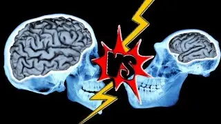 Comparison of Brains | Human Brain VS Animal Brain 世界上最大的大腦|大腦大小比較