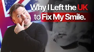 Dental Treatment Experience In Turkey | Andy&rsquo;s Journey