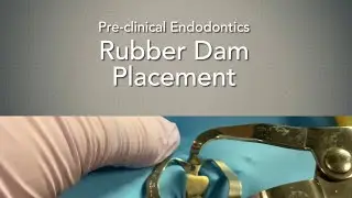 Rubber Dam Placement