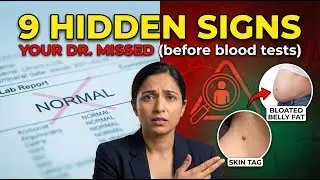 9 Warning Signs of Insulin Resistance (Blood Tests Miss This For Years)