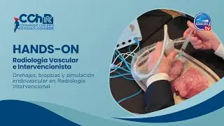 NOTA | Hands-On: Drenajes, biopsias y simulación endovascular en Radiología Intervencional #CChR2025