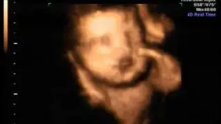 Chris Redfearn Jr.