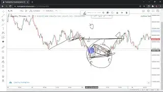 How to deal with Vix 75 index's unpredictability -  A guide to Profitability