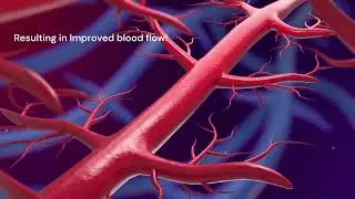 Surrey Men's Health Centre shockwave therapy for ED    #erectiledysfunction #SurreyBC #ED #shockwave