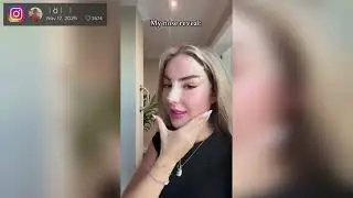 Emma Fernlund: User spotten nach Beauty-OP &ndash; 