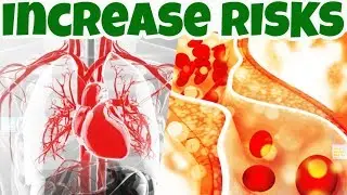 These 7 BAD EATING HABITS Will Increase Your STROKE RISK and HEART DISEASES Risk.