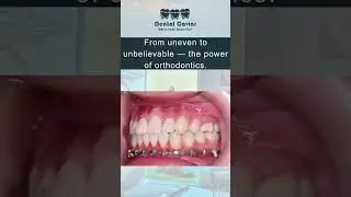 Best dental clinic in multan/ Best dentist in multan