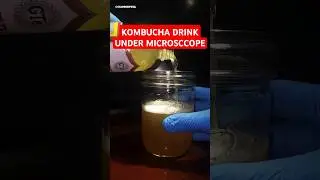 Kombucha Drink Under A Microscope (CHUNKY PART)