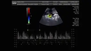Alien: Out of the Shadows - Ultrasound
