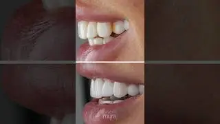 They searched &ldquo;The best dental clinic in Antalya&rdquo; &mdash; and found us.