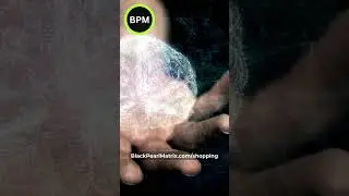 POSTOPLAN