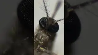 Microscope View: What a Mosquito Really Looks Like 😳🔬🦟