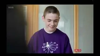 World first epilepsy device fitted in UK boy's skull