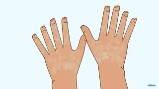 How to reduce risk of coronavirus infection (COVID-19)